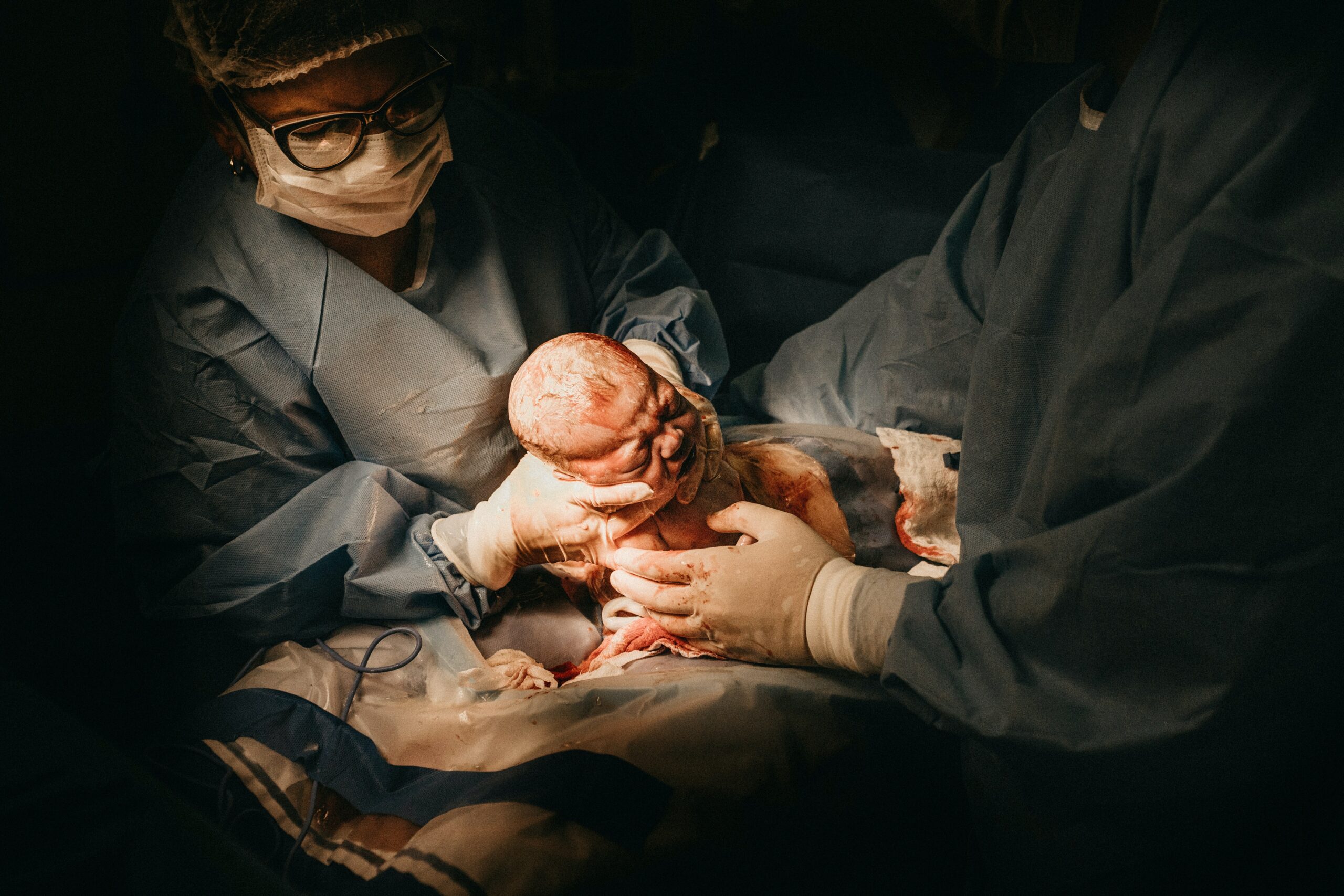 Congenital Hydrocephalus