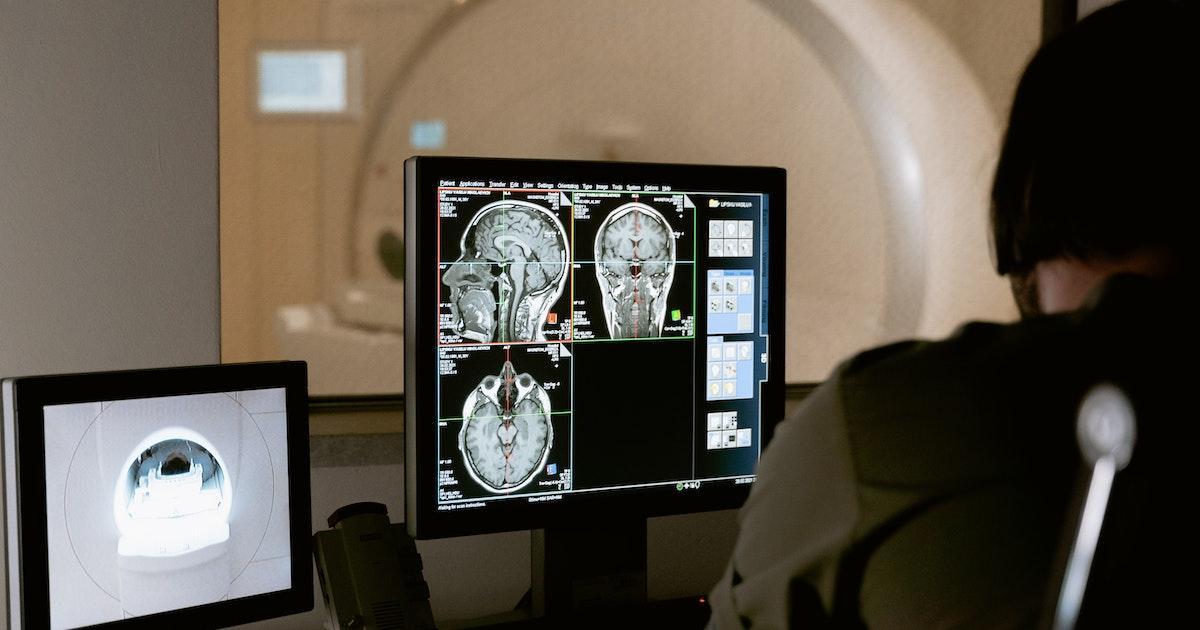 Brain scan for traumatic brain injury