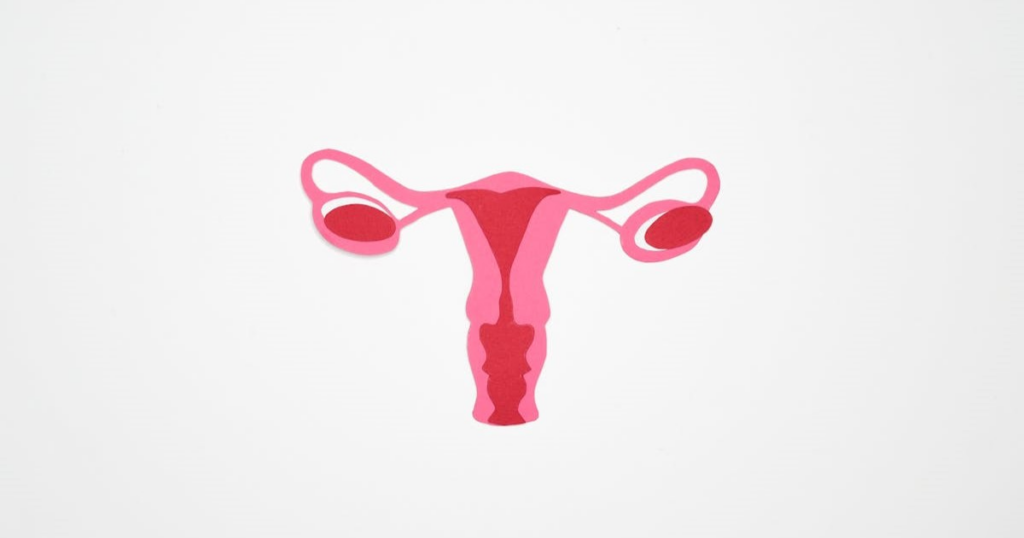 Uterine fibroids
