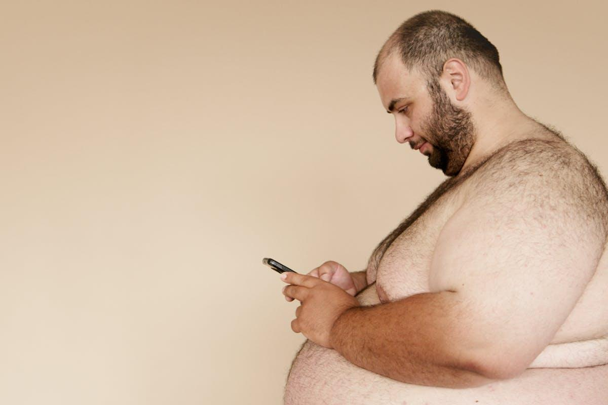 Surgical procedures for gross obesity